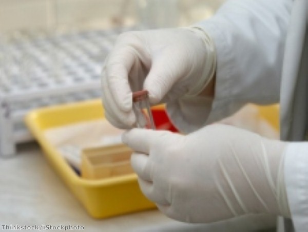 Scientists to benefit from new cancer database